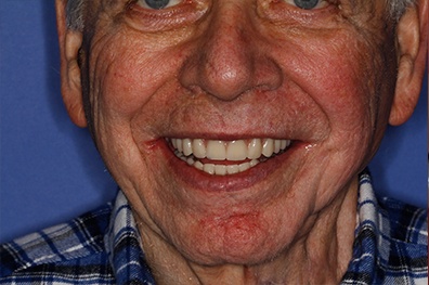 Older man with flawless smile after cosmetic dentistry