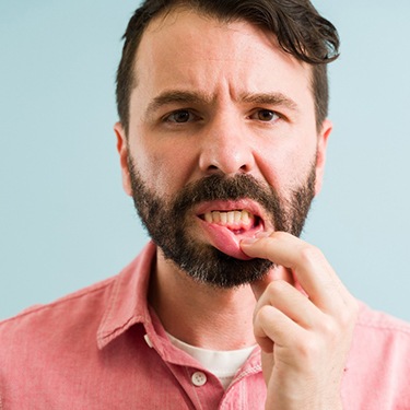 A young man showing that he suffers from gingivitis