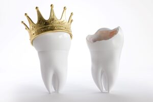 A large fake tooth with a gold crown next to a broken tooth