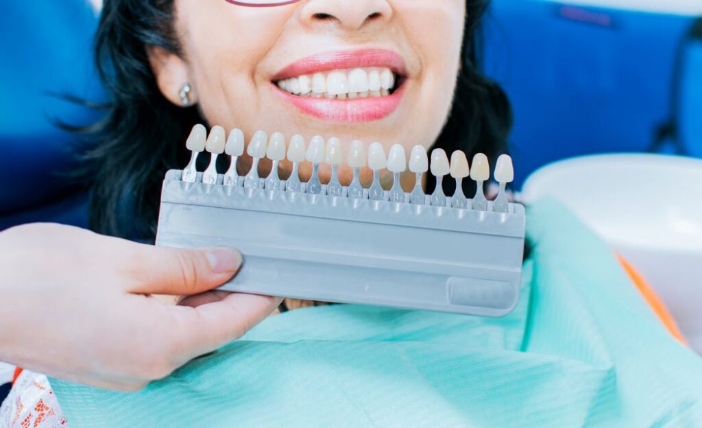 A woman smiling next to a tooth shade guide.