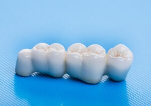 closeup of a dental bridge with a blue background